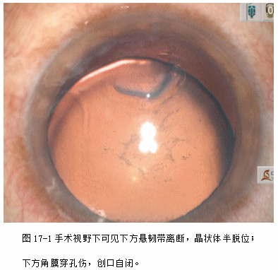 ZY016_85_2.gif